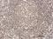 Oligodendrocyte Transcription Factor 3 antibody, H00167826-B01P, Novus Biologicals, Immunohistochemistry paraffin image 