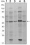 SMAD Family Member 4 antibody, STJ98385, St John