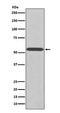 WT1 Transcription Factor antibody, M00199-1, Boster Biological Technology, Western Blot image 