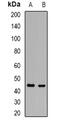 Acid ceramidase antibody, abx141347, Abbexa, Western Blot image 