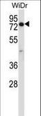 Coiled-Coil Domain Containing 22 antibody, LS-C168411, Lifespan Biosciences, Western Blot image 