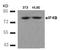 Eukaryotic Translation Initiation Factor 4B antibody, AP09474PU-N, Origene, Western Blot image 