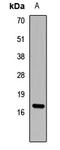 Interleukin 1 Alpha antibody, LS-C667872, Lifespan Biosciences, Western Blot image 