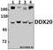 DEAD-Box Helicase 20 antibody, A05291-1, Boster Biological Technology, Western Blot image 