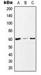 Myc-associated zinc finger protein antibody, LS-C352489, Lifespan Biosciences, Western Blot image 