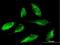 SCO Cytochrome C Oxidase Assembly Protein 1 antibody, H00006341-B01P, Novus Biologicals, Immunocytochemistry image 