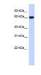 GTP Binding Protein 2 antibody, NBP1-57648, Novus Biologicals, Western Blot image 