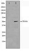 TNF Receptor Superfamily Member 10a antibody, TA347514, Origene, Western Blot image 