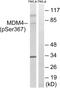 MDM4 antibody, GTX55445, GeneTex, Western Blot image 