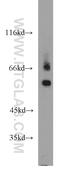 Tetratricopeptide Repeat Domain 39B antibody, 23432-1-AP, Proteintech Group, Western Blot image 