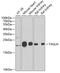 Transgelin antibody, GTX33555, GeneTex, Western Blot image 