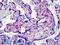 Inhibitor Of Nuclear Factor Kappa B Kinase Regulatory Subunit Gamma antibody, LS-B4878, Lifespan Biosciences, Immunohistochemistry paraffin image 
