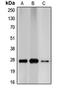 Cyclin Dependent Kinase Inhibitor 1B antibody, LS-C351994, Lifespan Biosciences, Western Blot image 