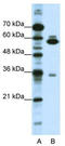 Zinc Finger Protein 446 antibody, TA345232, Origene, Western Blot image 
