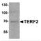Telomeric Repeat Binding Factor 2 antibody, TA349030, Origene, Western Blot image 
