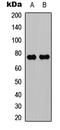 Protein Kinase C Theta antibody, LS-C368473, Lifespan Biosciences, Western Blot image 