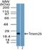 Transmembrane Protein 26 antibody, TA337158, Origene, Western Blot image 