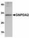Glucosamine-6-Phosphate Deaminase 2 antibody, orb94271, Biorbyt, Western Blot image 