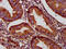 NAD Kinase 2, Mitochondrial antibody, CSB-PA676825LA01HU, Cusabio, Immunohistochemistry paraffin image 