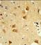 Derlin 1 antibody, GTX81054, GeneTex, Immunohistochemistry paraffin image 