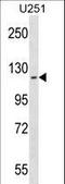 ATPase Cation Transporting 13A2 antibody, LS-C156639, Lifespan Biosciences, Western Blot image 