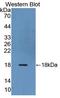 Relaxin Family Peptide Receptor 1 antibody, LS-C296215, Lifespan Biosciences, Western Blot image 