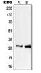 Phosphatidylinositol Glycan Anchor Biosynthesis Class X antibody, orb215205, Biorbyt, Western Blot image 