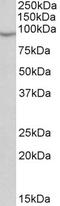 NADPH Oxidase 5 antibody, EB10585, Everest Biotech, Western Blot image 