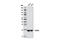 Cofilin 1 antibody, 8503S, Cell Signaling Technology, Western Blot image 