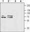 Purinergic Receptor P2X 1 antibody, PA5-77679, Invitrogen Antibodies, Western Blot image 