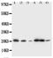 Signal Sequence Receptor Subunit 3 antibody, PA5-80072, Invitrogen Antibodies, Western Blot image 