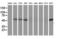 Sequestosome 1 antibody, LS-C172511, Lifespan Biosciences, Western Blot image 