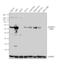 Aldehyde Dehydrogenase 1 Family Member A1 antibody, PA5-34901, Invitrogen Antibodies, Western Blot image 