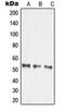 Matrix Metallopeptidase 14 antibody, orb214265, Biorbyt, Western Blot image 
