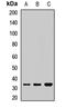 Paired Like Homeobox 2B antibody, LS-C668193, Lifespan Biosciences, Western Blot image 