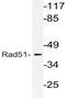 RAD51 Recombinase antibody, AP21099PU-N, Origene, Western Blot image 