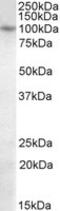 PR/SET Domain 1 antibody, MBS421738, MyBioSource, Western Blot image 