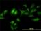 Adhesion Regulating Molecule 1 antibody, H00011047-M01, Novus Biologicals, Immunocytochemistry image 