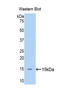 Mannan Binding Lectin Serine Peptidase 2 antibody, LS-C297435, Lifespan Biosciences, Western Blot image 