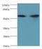 Adenosylhomocysteinase Like 1 antibody, MBS1494667, MyBioSource, Western Blot image 