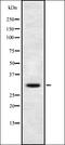 Iodothyronine Deiodinase 3 antibody, orb337328, Biorbyt, Western Blot image 