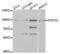 Periostin antibody, LS-C331819, Lifespan Biosciences, Western Blot image 