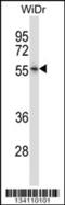 Photoreceptor-specific nuclear receptor antibody, 57-558, ProSci, Western Blot image 