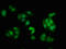 Protein Kinase C Alpha antibody, CSB-RA018699A638phHU, Cusabio, Immunofluorescence image 