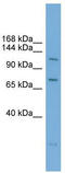 Poly(ADP-Ribose) Polymerase Family Member 10 antibody, TA329538, Origene, Western Blot image 