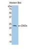 Slit Guidance Ligand 1 antibody, LS-C300075, Lifespan Biosciences, Western Blot image 