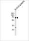 Fibrinogen Alpha Chain antibody, PA5-35319, Invitrogen Antibodies, Western Blot image 