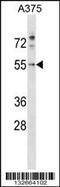 Programmed Cell Death 7 antibody, 57-134, ProSci, Western Blot image 