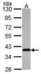 DNA-(apurinic or apyrimidinic site) lyase antibody, GTX100050, GeneTex, Western Blot image 