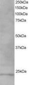 VPS28 Subunit Of ESCRT-I antibody, NB100-1399, Novus Biologicals, Western Blot image 